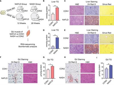 Comprehensive Transcriptome Profiling of NAFLD- and NASH-Induced Skeletal Muscle Dysfunction